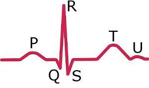 ECG PQRST