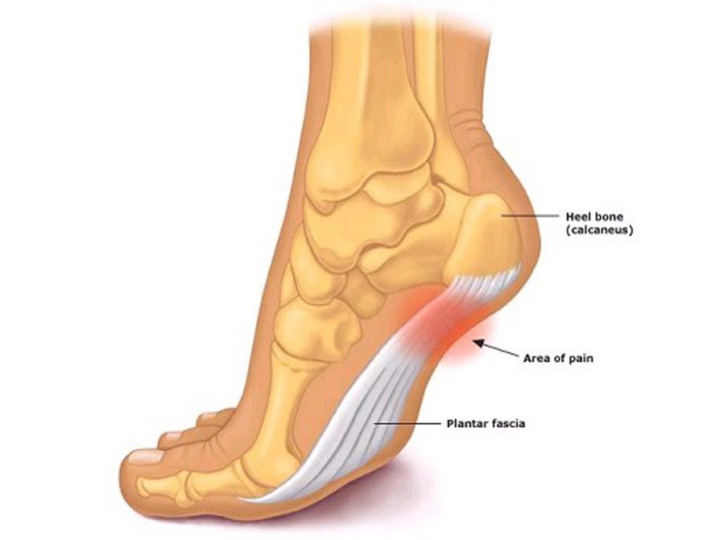 Rehabilitating the Plantar Fascia: Does Stretching Really Help? 