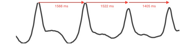 RR intervals PPG