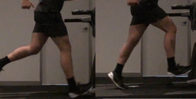 Running Analysis for Anterior (Front) Shin Pain